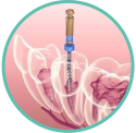 Endodoncia
