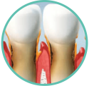 Periodoncia
